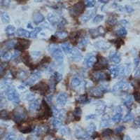 BLNK Antibody (phospho-Tyr96)