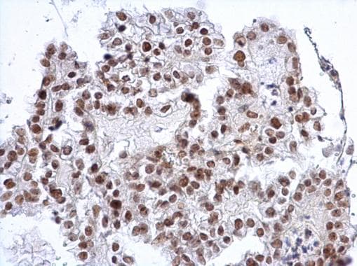SP3 Antibody (aa1-74)