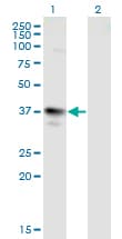 MAGEA3 Antibody (clone 6D10)