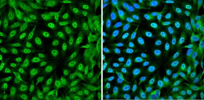 YAP / YAP1 Antibody