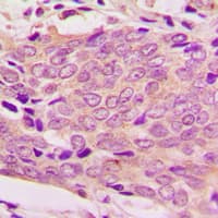 MRPL51 Antibody (Internal)