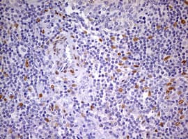 PRX-1 / PRRX1 Antibody (clone OTI2B2)