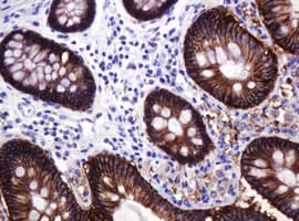 CA12 / Carbonic Anhydrase XII Antibody (clone OTI4G3)