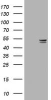 Monoclonal Mouse anti-Human TP / Thymidine Phosphorylase Antibody (clone OTI1H10, IHC, WB)
