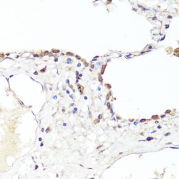 EGFR Antibody