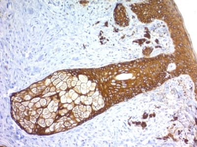 KRT76 / Keratin 76 Antibody (clone KRTH/1576R)