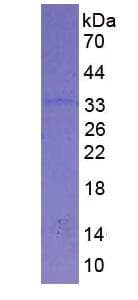 Human FGG / Fibrinogen Gamma Protein (Recombinant His, N-Terminal)