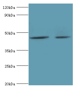 Polyclonal Rabbit anti-Human BCKDK Antibody (aa153-412, IHC, WB)