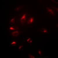 NELFE / RD / RDBP Antibody