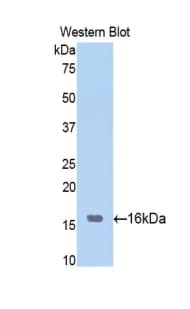 SIRT7 / Sirtuin 7 Antibody (aa275-397)