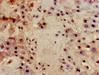 ITGB4 / Integrin Beta 4 Antibody