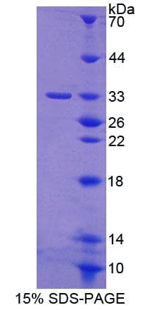 Human PKD3 / PRKD3 Protein (Recombinant His-T7)