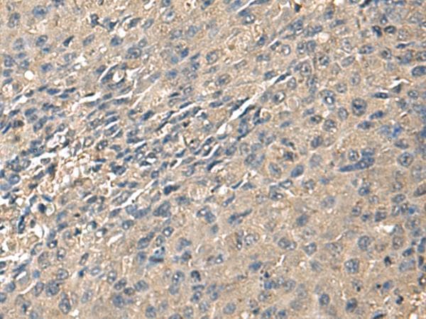 Polyclonal Rabbit anti-Human ZG16 Antibody (IHC, WB)