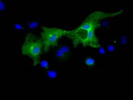 L1CAM Antibody (clone OTI2A11)