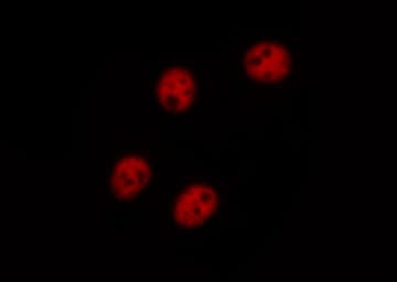 NFKBIB / IKB Beta / IKBB Antibody (phospho-Ser23)