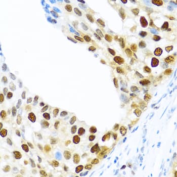 Polyclonal Rabbit anti-Human KHDRBS2 / SLM-1 Antibody (IHC, WB)