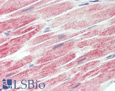 IHC-plus™ Polyclonal Rabbit anti-Human BICD1 Antibody (aa300-350, IHC)