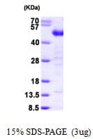 Human TES / Testin Protein (Recombinant His)