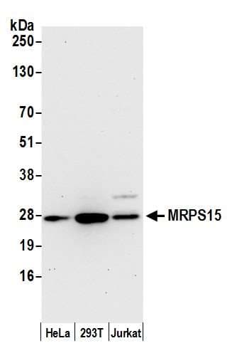 Polyclonal Rabbit anti-Human MRPS15 Antibody (aa207-257, WB)