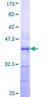 Human PHF21A / BHC80 Protein (Recombinant GST, N-terminus)