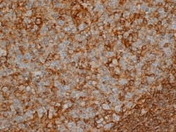 Monoclonal Mouse anti-Human CD44 Antibody (clone Bu52, IHC)