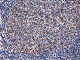 TUBAL3 Antibody (clone OTI4D8)