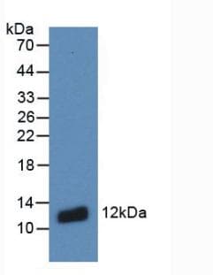 S100A8 / MRP8 Antibody