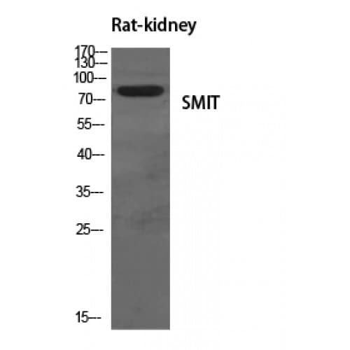 SLC5A3 Antibody (190-270 aa, Internal)