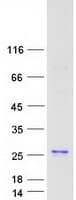 Human p21-ARC / ARPC3 Protein (Recombinant Myc-DDK (Flag))