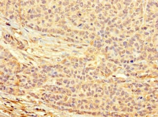 Polyclonal Rabbit anti-Human C13orf39 Antibody (IHC, IF)