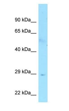 FAM133B Antibody (C-Terminus)