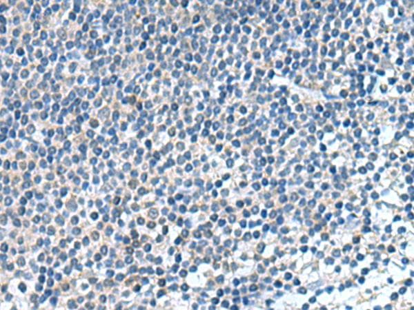 Polyclonal Rabbit anti-Human KIF2A Antibody (IHC, WB)