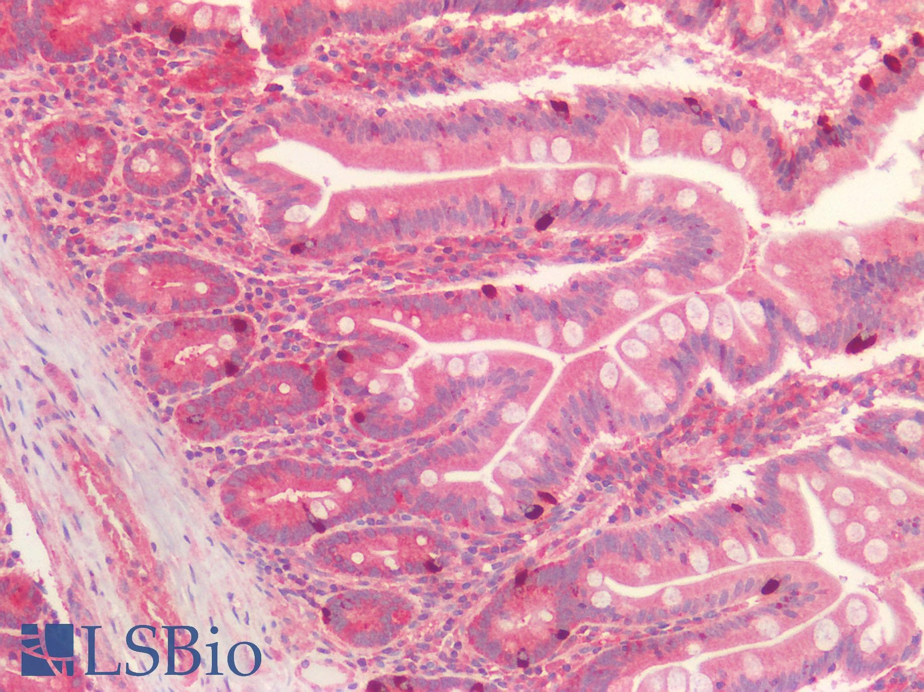 SEMA3C / Semaphorin 3C Antibody (aa292-396)