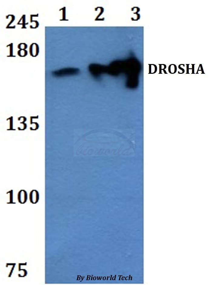 Polyclonal Rabbit anti-Human DROSHA / RNASEN Antibody (WB)