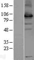 USP13 Protein (Over-Expression Lysate Myc-DDK (Flag))