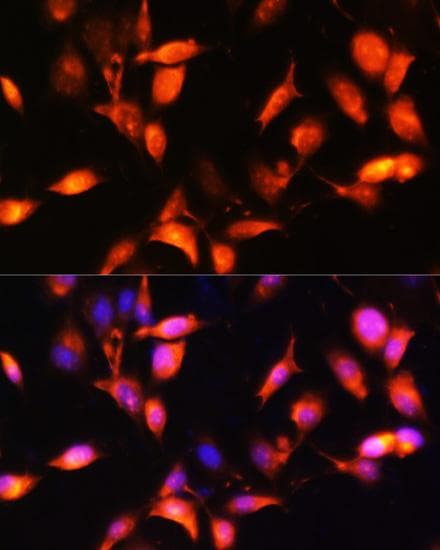 Polyclonal Rabbit anti-Human ARL4A / ARL4 Antibody (IHC, IF)