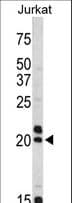 IHC-plus™ VIP Antibody (aa139-167)