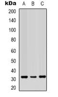 Polyclonal Rabbit anti-Human VDAC1 / PORIN Antibody (N-Terminus, WB)