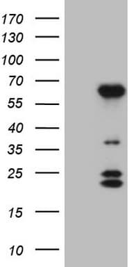 Monoclonal Mouse anti-Human BTBD10 / GMRP-1 Antibody (clone OTI7D3, Carrier-free, IHC, WB)