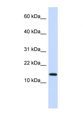 Polyclonal Rabbit anti-Human NME1 / NM23 Antibody (N-Terminus, IHC, WB)