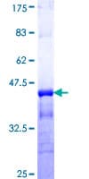 Human KCNC3 / Kv3.3 Protein (Recombinant GST, N-terminus)