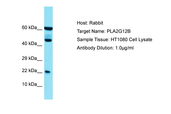 PLA2G12B Antibody (N-Terminus)