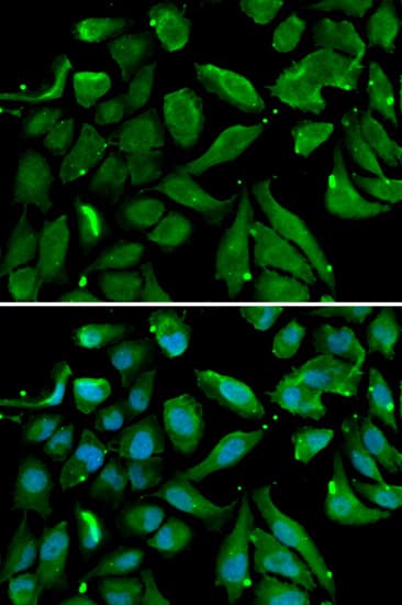 Polyclonal Rabbit anti-Human NFKBIB / IKB Beta / IKBB Antibody (IHC, IF, WB)