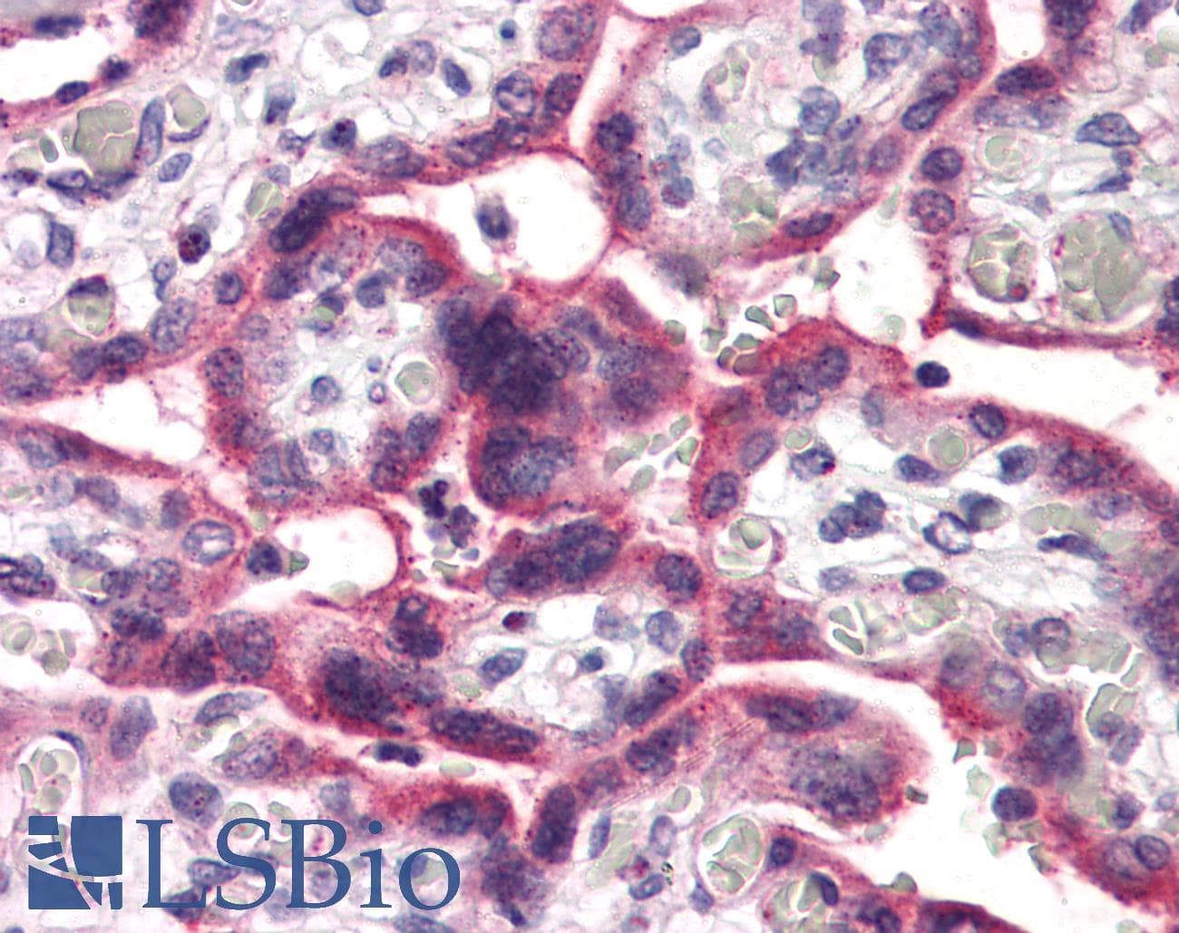 IHC-plus™ Polyclonal Rabbit anti-Human SLC5A6 / SMVT Antibody (Internal, IHC)