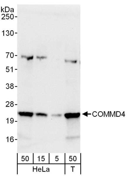 COMMD4 Antibody (aa149-199)