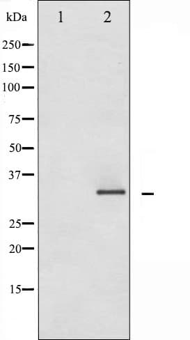 CCND1 / Cyclin D1 Antibody (phospho-Ser90)