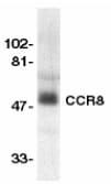 Polyclonal Rabbit anti-Human CCR8 / CD198 Antibody (WB)