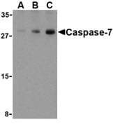 IHC-plus™ Polyclonal Rabbit anti-Human CASP7 / Caspase 7 Antibody (IHC, WB)