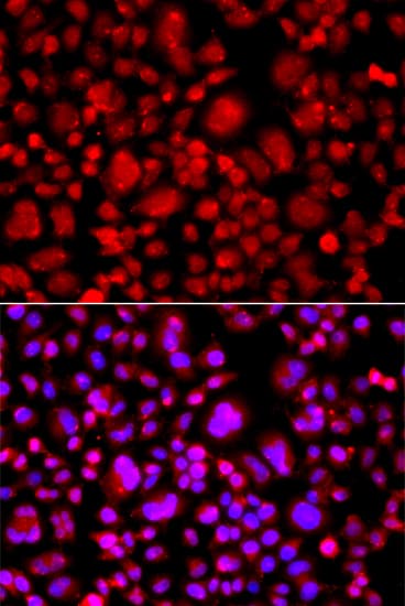 TP53BP2 / ASPP2 Antibody