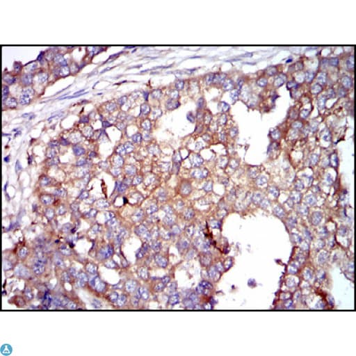 G6PD Antibody